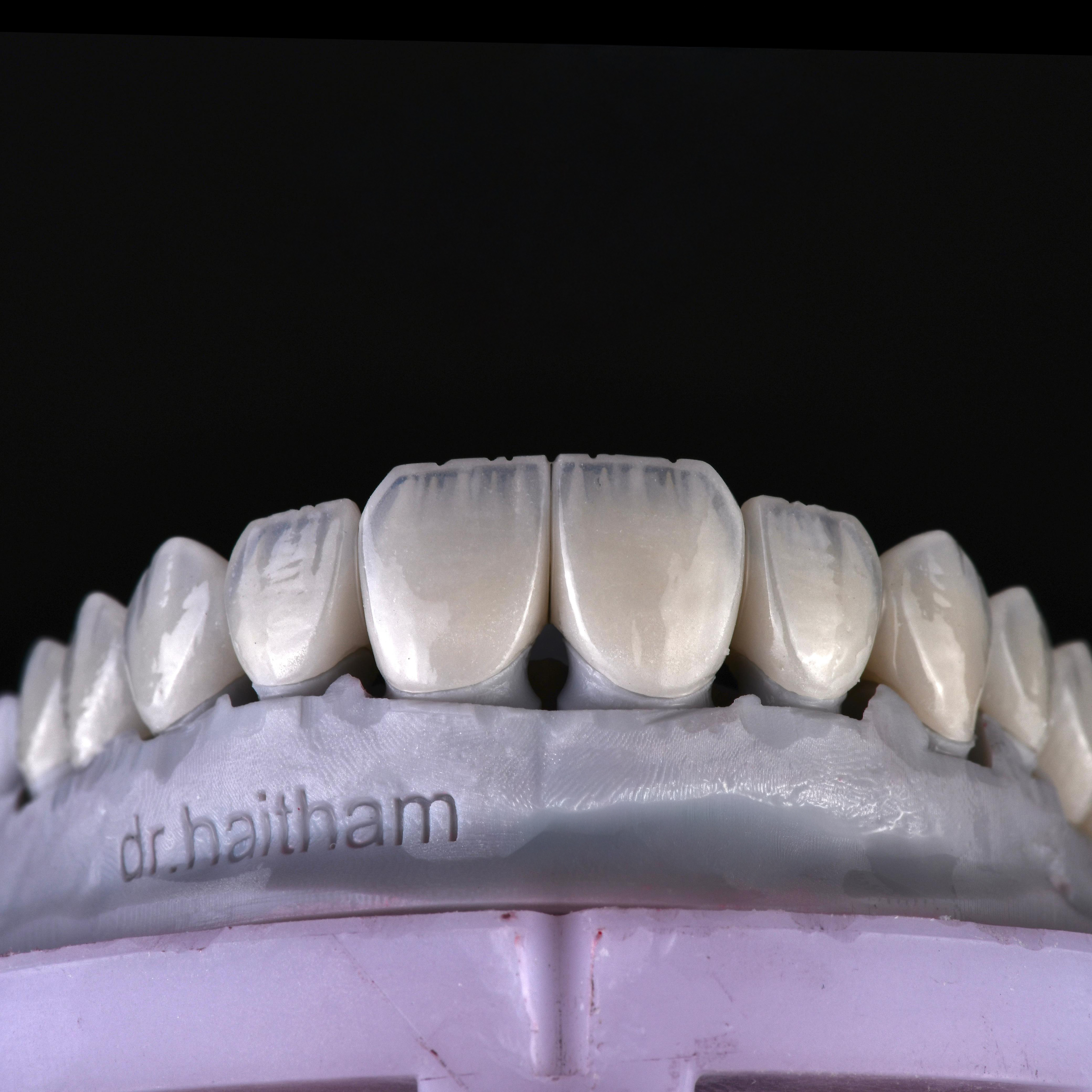 تجميل الأسنان